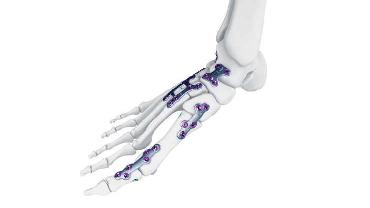 Foot & Ankle | DePuy Synthes